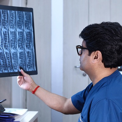 Spine CT Scan Meerut