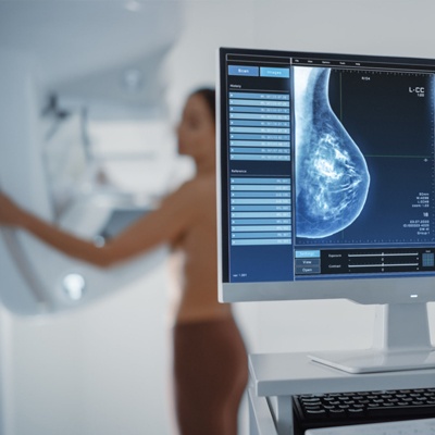 3D Digital Mammography Meerut